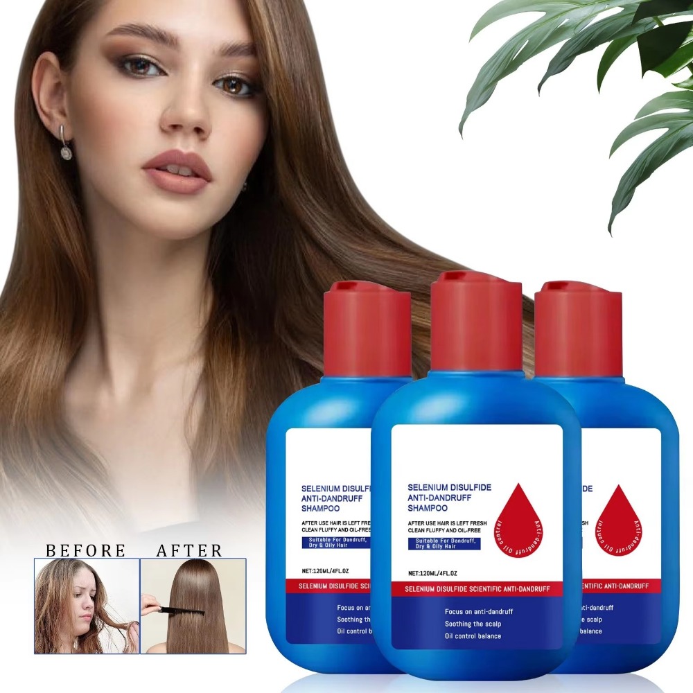 새로운 120ml 니포리 샴푸 오일 컨트롤 비듬 방지  - Hair Care Dandruff 리뷰 및 가격