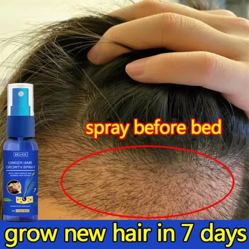 빠른 생강 모발 성장 스프레이, 모발 뿌리 강화, 탈모 - Hair Care Lotion 리뷰 및 가격